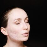 Skin Care in Hindi WellHealthOrganic: Essential Tips for Healthy Skin